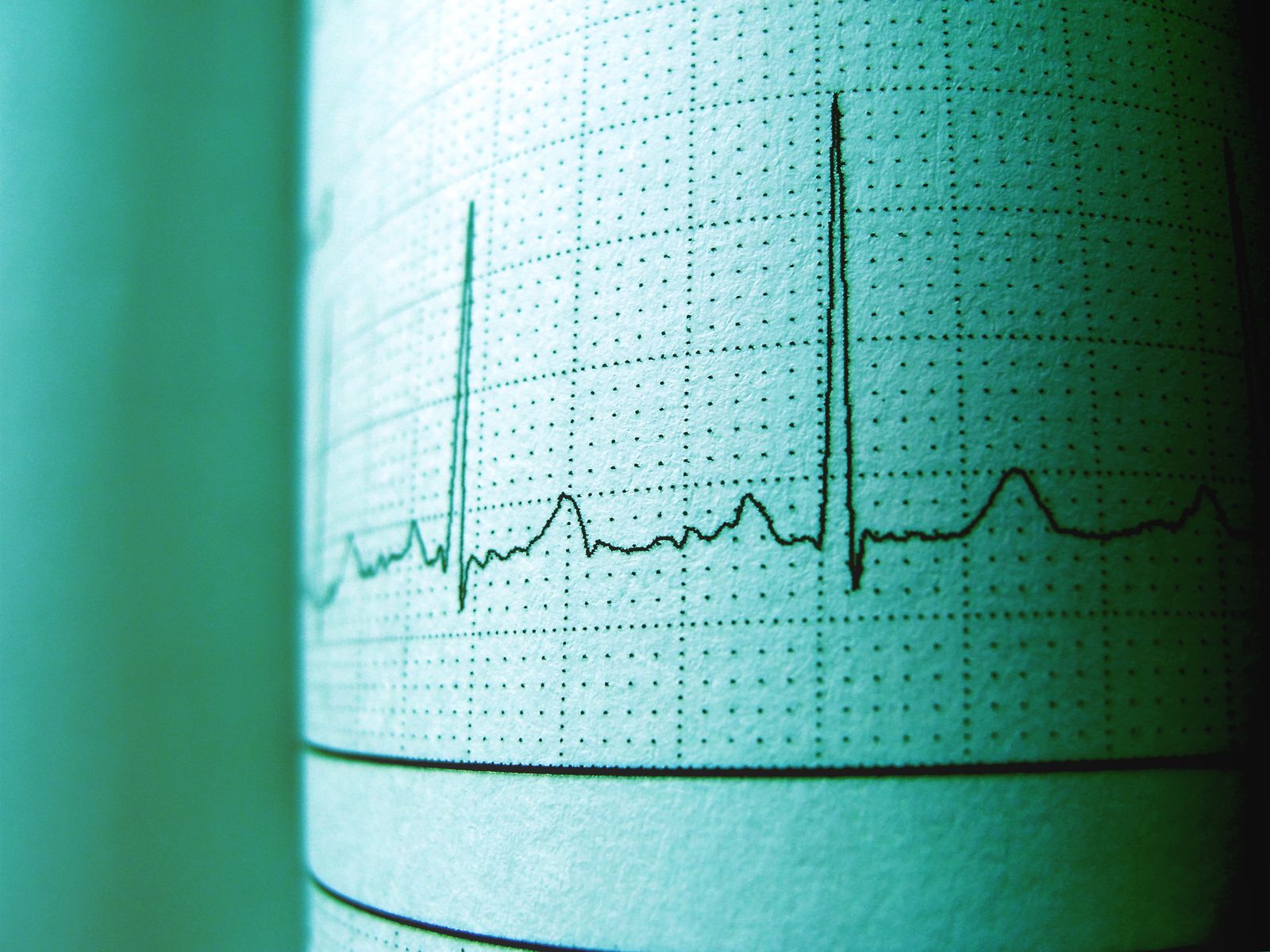 EKG-Elektroden und Zubehör: Auswahl für Diagnostik in Klinik und Praxis