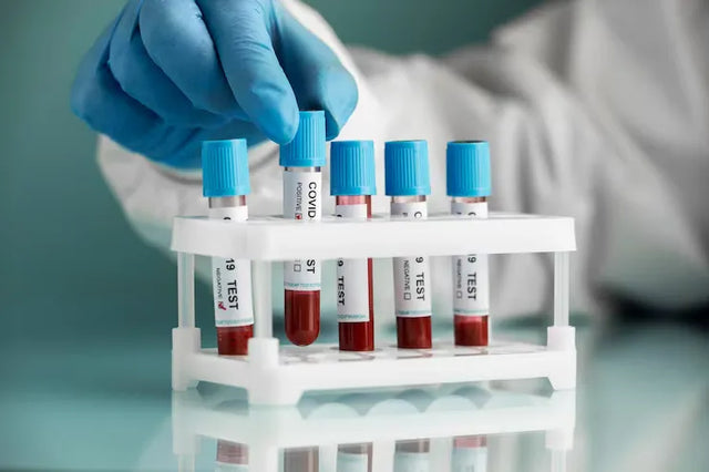 Blood Collection