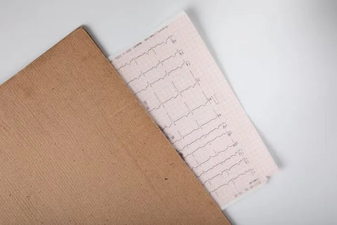 ECG Paper
