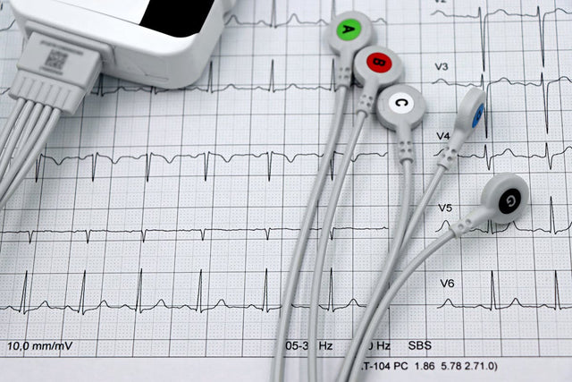 Ecg Electrodes
