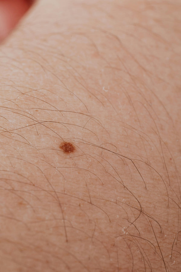 Skin dermatology close-up