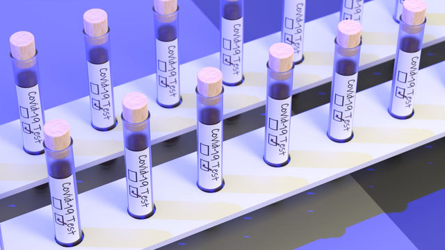 Test Strips Control Solutions