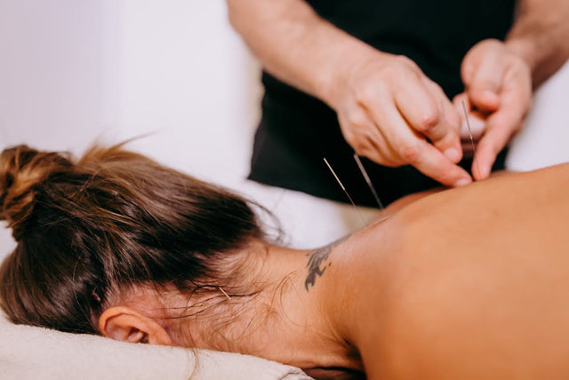 Acupuncture Needles & Accessories