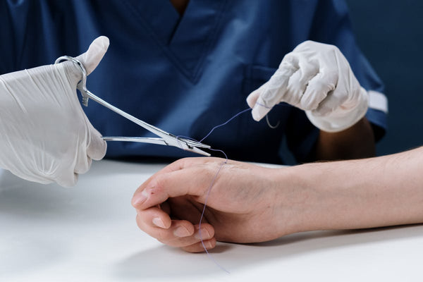 Steri Strips
