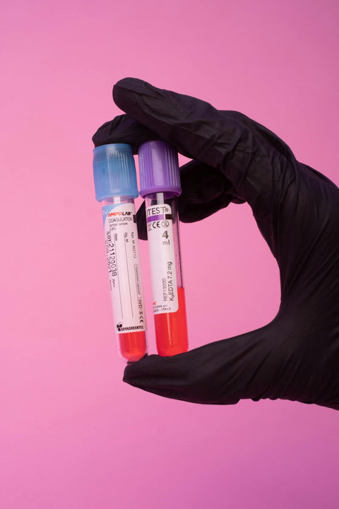 Blood Sedimentation Racks