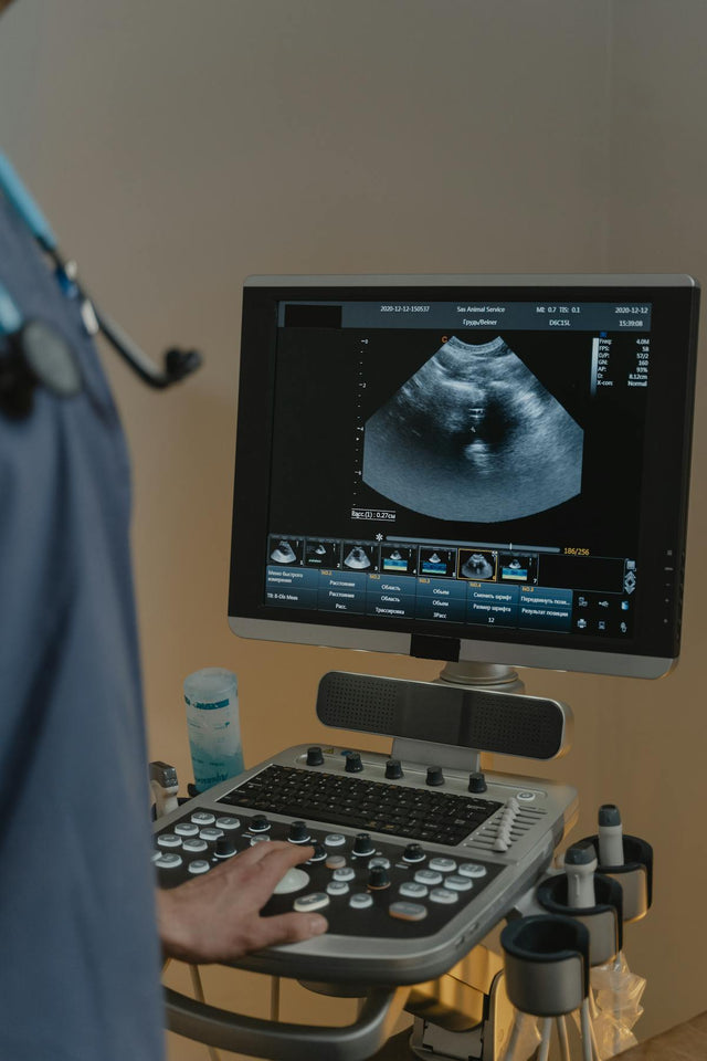 Ultrasound Machines