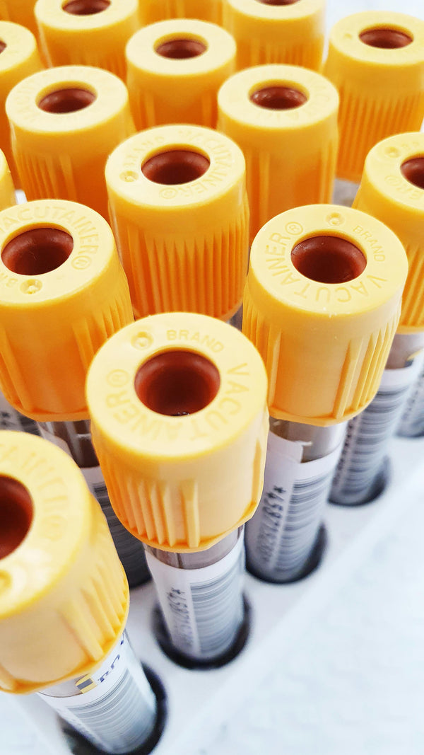 Blood collection vials