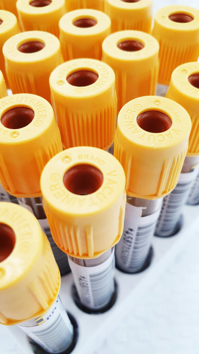 Blood collection vials