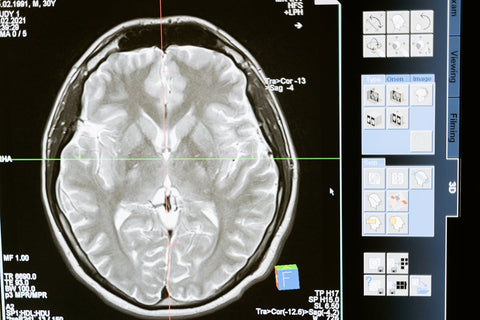 Brain & Memory Enhancers