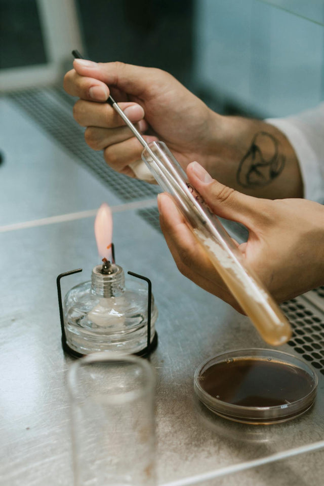 Urine Analysers