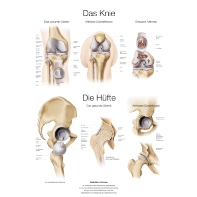 Teaching Chart "The Knee and Hip", 70x100cm