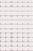 EKG-Papier f. Siemens Sicard 440, 148mmx25m