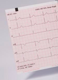 EKG-Papier f. Schiller Cardiovit AT 3, 70 mm x 100 mm x 200 Blatt