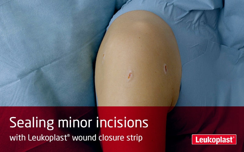 Leukoplast wound closure strip 6x75mm weiß