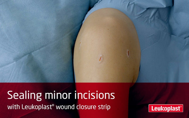 Leukoplast wound closure strip 6x75mm weiß
